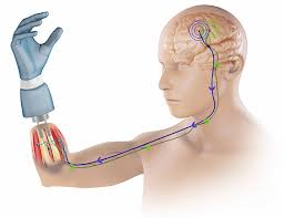 Neuroprosthetic Systems(hand)